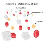 Anaemia - Deficiency of Iron