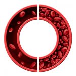 Iron deficiency in blood